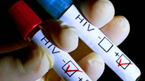 Первоуральцев приглашают анонимно сдать тест на ВИЧ